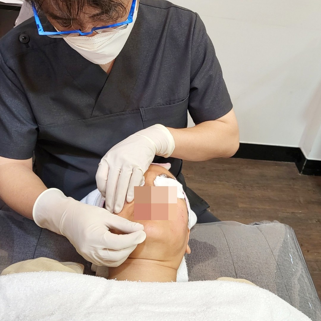 후한의원 제주점 침 제거 시술 장면